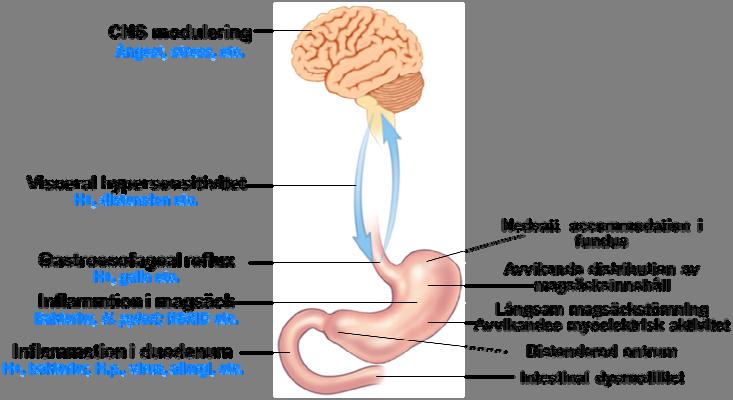 Funktionell dyspepsia Patofysiologiska mekanismer - Stanghellini et al