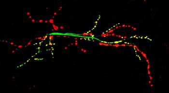 enheten i nervsystemets signalering synapser finns främst på dendriter