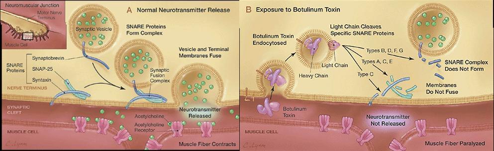 Botulinium toxin