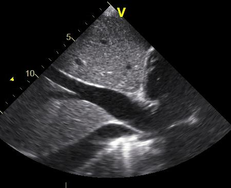 Pulmonary