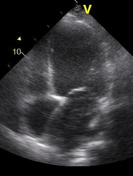 Pulmonary