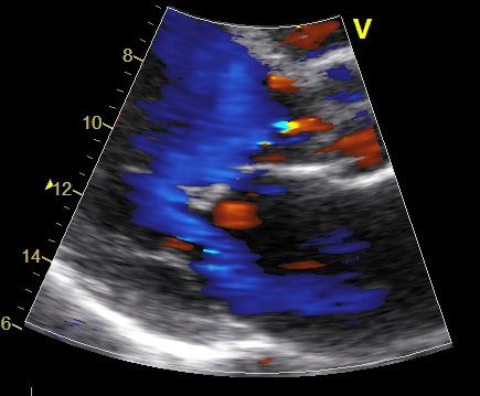 Pulmonary