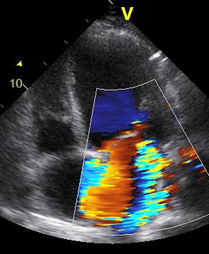 Pulmonary