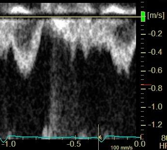 output E/A 2.1 S/D?