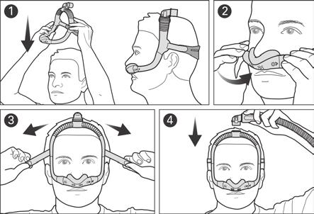 Tillpassa masken 1. Dra ramen och huvudbandet över huvudet tills knäröret sitter på ovansidan och huvudbandet är placerat bakom huvudet. 2. Placera mjukdelen under näsan. 3.