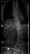 as a complement in clinical sitting analysis, Advances in