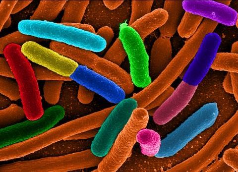 RÖTNING En mikrobiell process Rätt mikrober Metanogena archeae G A S Rätt