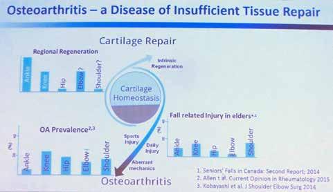 Cutting Edge Rheumatology Frank Wollheim om att definiera OA som resultatet av en ond cirkel av mekaniskt inducerad steril inflammation.