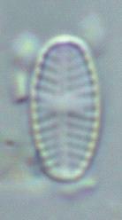 2,2-2,8µm), d girdle