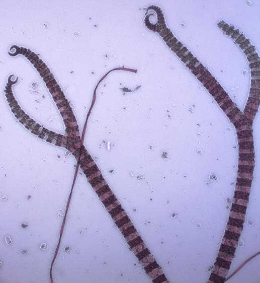 Medins Havs- och Vattenkonsulter AB Foto. Mikroskopbilder av rödalgen ullsläke (Ceramium tenuicorne) från station Ma7 i Pukaviksbukten. Arten är vanlig i litoralen där den kan vara bältesbildande.