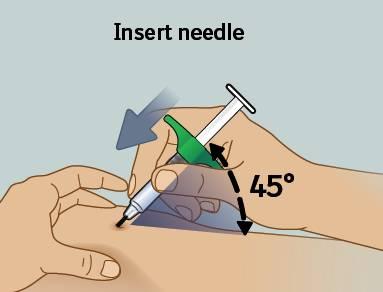 8) Stick in nålen Stick in nålen Håll sprutan i cirka 45 graders vinkel mot injektionsstället och