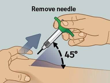 10) Dra ut nålen ur huden Dra ut nålen Dra ut nålen ur huden i samma vinkel som du stack in den (45
