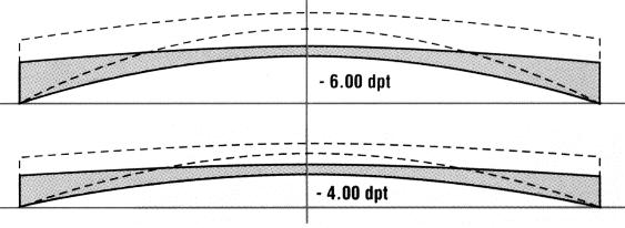 Här gör man en linsen flatare, genom att vid tillverkningen kalkylera in låga grader av cylindriska och sfäriska värden i linsytan för att kompensera randastigmatism och styrkefel i linsens periferi.