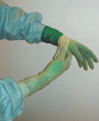 32 33 34 15 Byta en kontaminerad /perforerad handske under operationen Med det patenterade Biogel punktionsindikatorsystemet ser man, i närvaro av vätska, om en handske har punkterats genom att en