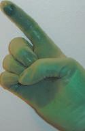 Om en kontaminerad/perforerad handske måste bytas när man är sterilklädd tar man av den yttre handsken genom att dra mudden över handflatan så att handsken vänds ut och in (bild 33).