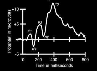 2 som sker innan ett stimulus exponeras och reaktionen efter stimuli utan någon mätbar fördröjning mellan hjärnaktivitet och registrering från hjärnbarken (Woodman, 2010).