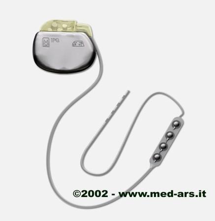 Deep brain stimulation 2 elektroder i