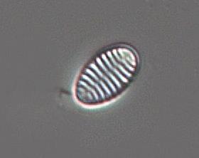 Tabellaria flocculosa, Staurosira venter, Fragilaria gracilis (Figur 4), Fragilaria oldenburgioides och Stauroforma exiguiformis, som alla trivs i framför allt