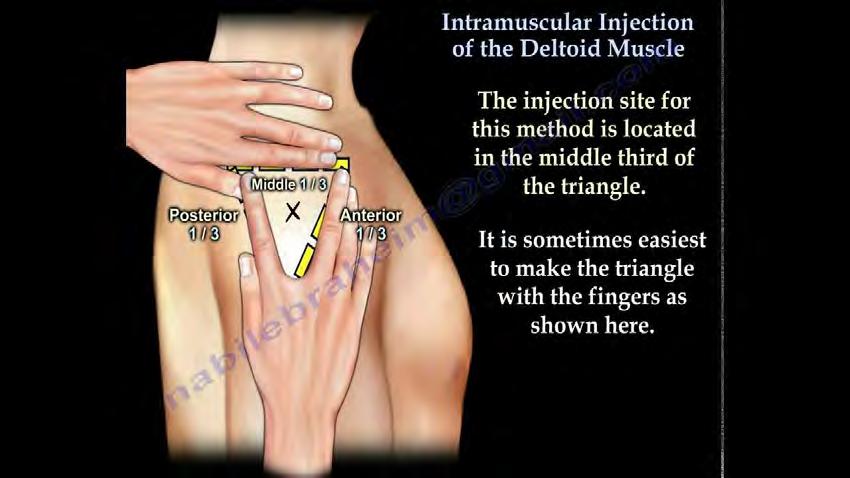 Intramsklär injektion https://www.
