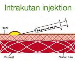 Vanligaste administrering är via: Intramsklär injektion på överarmen i deltoides mskeln,