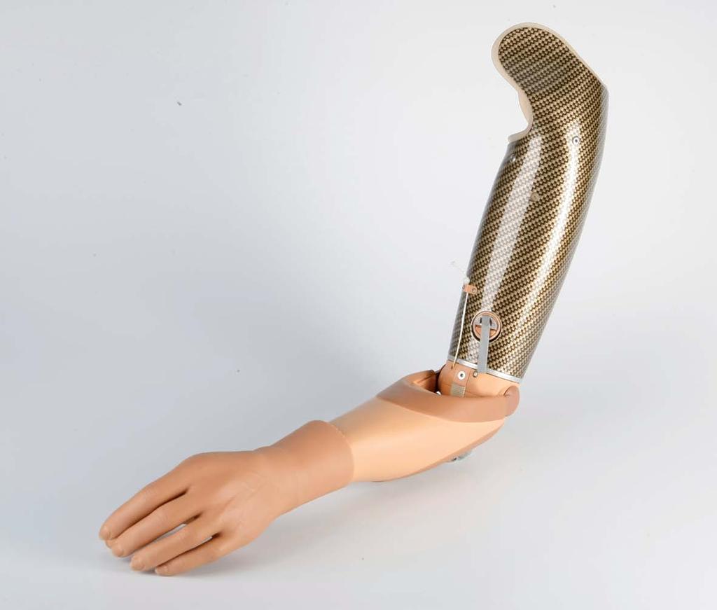 Proteskomponenter När du ska välja armprotes finns det tre olika typer tillgängliga: myoelektriska, vajerstyrda och kosmetiska armproteser.