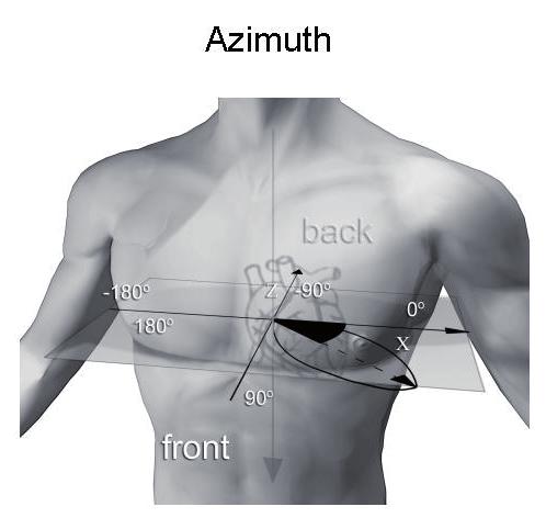 22 Aigars Rubulis A B Figure 7. (Reprinted with permission from L. Wecke: Cardiac Memory Studies in Two Human Models.