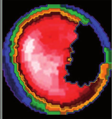 of repolarization in M cells (mid-myocardial cells) (adapted from Yan, Shimizu & Antzelevitch, Circulation 1998;98:1928-36).