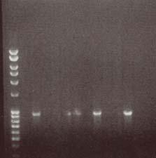 Exempel på gel med konfirmerade PCR-produktstorlekar, där T7-primrar utanför kloningskasetterna användes, vilket gav produkter 300baspar (bp) större än de klonade fragmenten.
