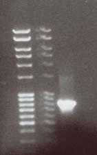 pe-rekombinanter i Mach-1 efter site directed mutagenesis I Figur 10 ses sekvensresultaten från kromatogrammen erhållna från ph med en dålig sekvens och fel läsram (Figur 10A), pe med punktmutation