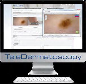 Teledermatologi Teledermatologi med en Dino-Lite Dermascope Det holländska sjukvårdsinstitutet Ksyos Tele Medical Center fokuserar sig på forskning, utveckling och införande av telekonsultation inom