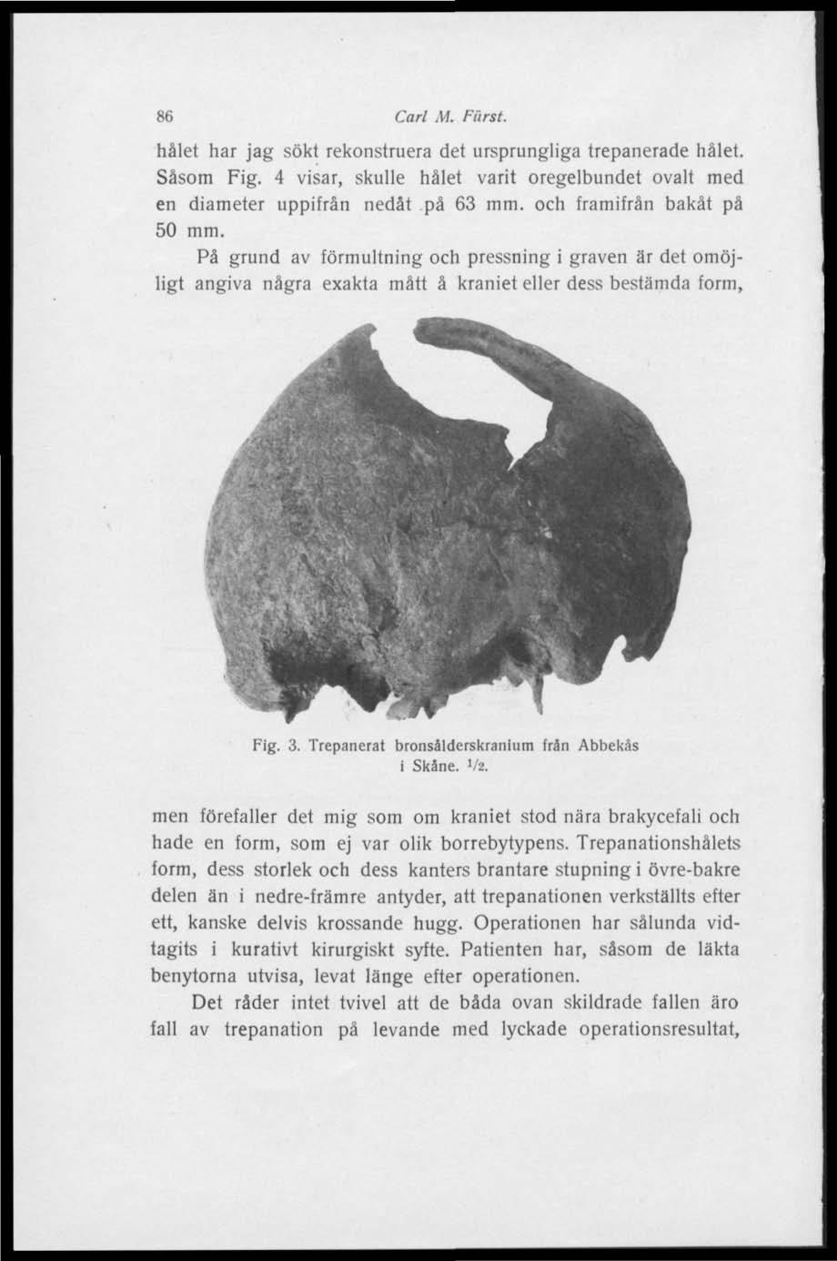 86 Carl M. Fiirst. hålet har jag sökt rekonstruera det ursprungliga trepanerade hålet. Såsom Fig. 4 visar, skulle hålet varit oregelbundet ovalt med en diameter uppifrån nedåt på 63 mm.