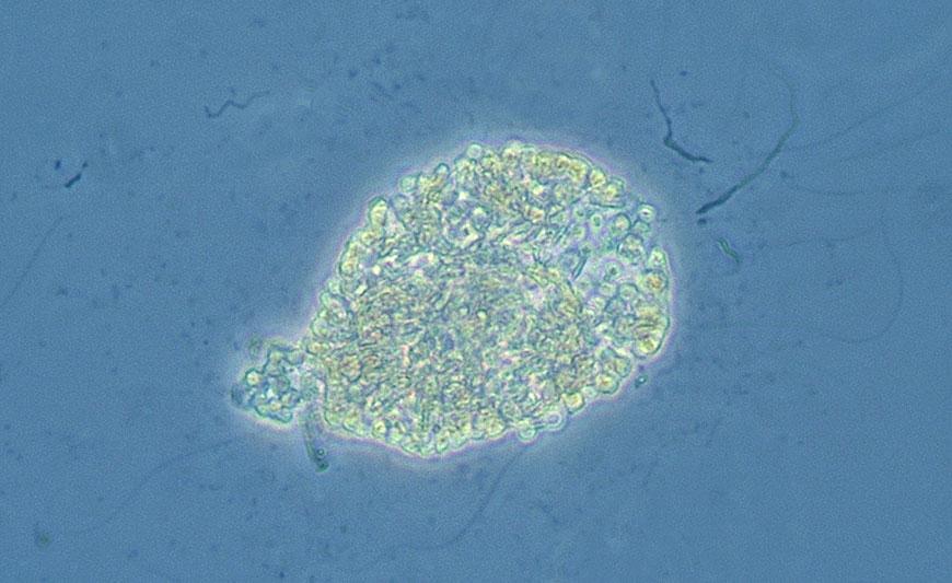 Medins Biologi Kemi Miljö Planktonalgen Gonyostomum semen.