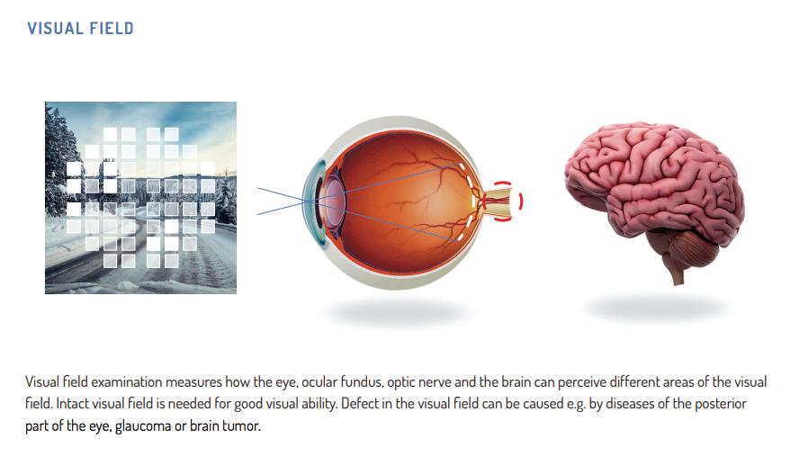 Synfält Undersökningen av synfältet används för att mäta hur ögat,