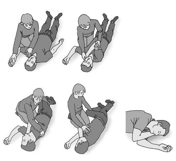 Så här lägger man någon i stabilt sidoläge: 1. Man ställer sig på knä vid sidan av den medvetslöse, som ska ligga på rygg. 2.