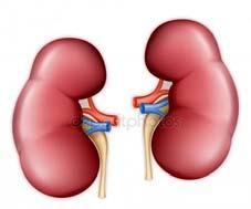 NSAID- Non Steroid Antiinflammatory