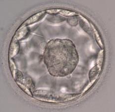 Man kan därför se att återföring av frysta så kallade blastocyster (dag 5/6) nu är