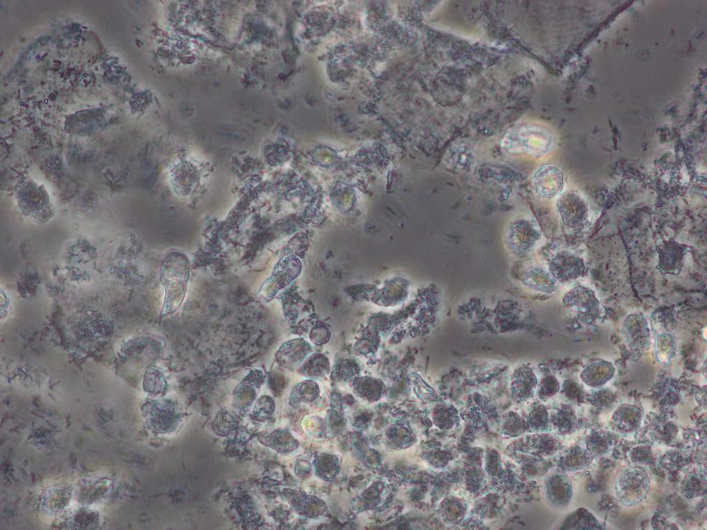 Trichomonas Behandling: