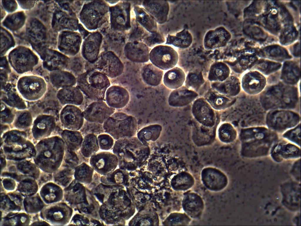 Vaginal Atrofi Före puberteten och efter menopaus Efter partus och under amning Hos en del