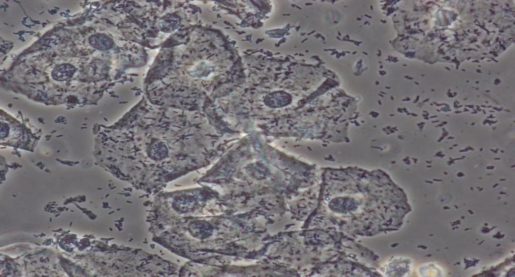 Östrogen har positiva effekter på epitelceller 1) bidrar till produktion av antimikroba peptider = kroppens eget antibiotika 2) inducerar