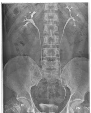 Slätröntgen innebär att man inte tillför kontrastmedel. Exempel: Skelettröntgen Lungröntgen strålriktning bakifrån och fram, sk PA- undersökning, pga att hjärtat ligger mer ventralt än dorsalt.