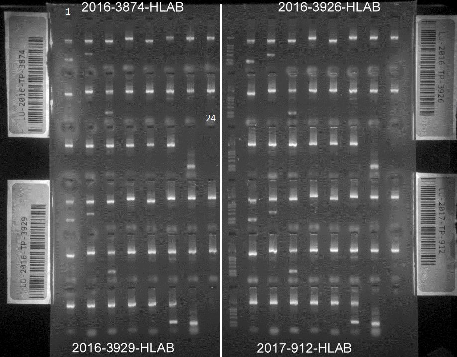 Figur 3. Gelbild från första körning med Olerup SSP HLA-B*57:01 kit. Figuren illustrerar att det gick att påvisa grund- och subtypning i alla prover.