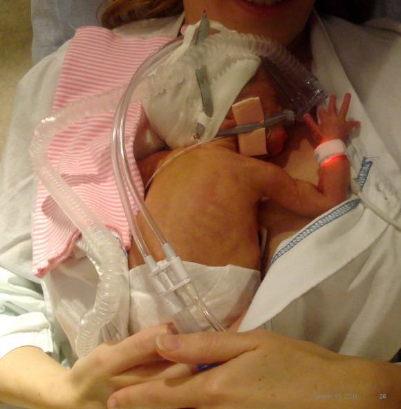 Neonatal intensivvård, KI, Huddinge Bild ur
