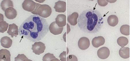 A. phagocytophilum - betesfeber Intracellulära bakterier besläktade med rickettsier Transstadiell överföring (transovariell: