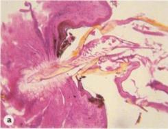 Hemimetabol utveckling