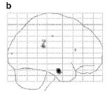 responses in amygdala assessed