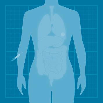 16 Tumörselektivitet via EPR-effekten ger förutsättningar för bättre precision i MR-diagnostik och radionuklidbehandling A B C