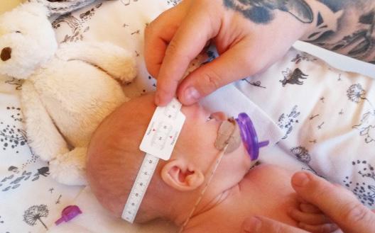På Astrid Lindgrens barnsjukhus vid Karolinska universitetssjukhuset erbjuder vi hemsjukvård till barn med behov av specialistvård under nyföddhetsperioden.