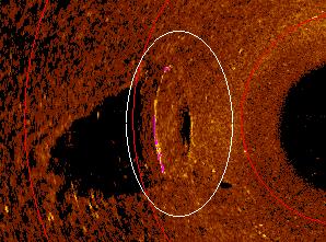 Marinarkeologisk inventering vid Gräfsnäs slott 13 Pg 2. Vid lagunen Mjuk detritusgyttja. Gropen var 0,7 meter djup. Fynd: enstaka mindre tegelfragment.