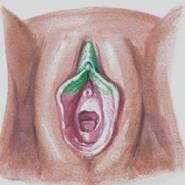 Klitoridektomi