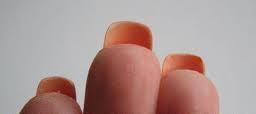 naglar är: Svåra att desinfektera Kan göra hål i handskar